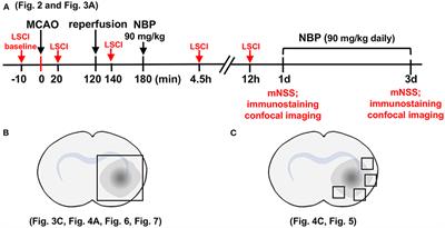 DL-3n-Butylphthalide Improves Blood–Brain Barrier Integrity in Rat After Middle Cerebral Artery Occlusion